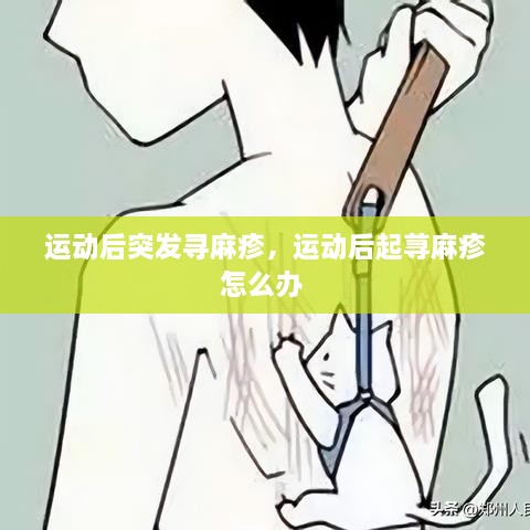 运动后突发寻麻疹，运动后起荨麻疹怎么办 