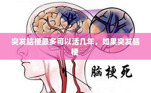 突发脑梗最多可以活几年，如果突发脑梗 