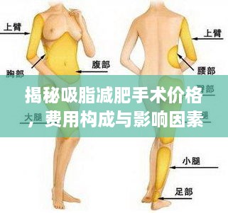 揭秘吸脂减肥手术价格，费用构成与影响因素全解析